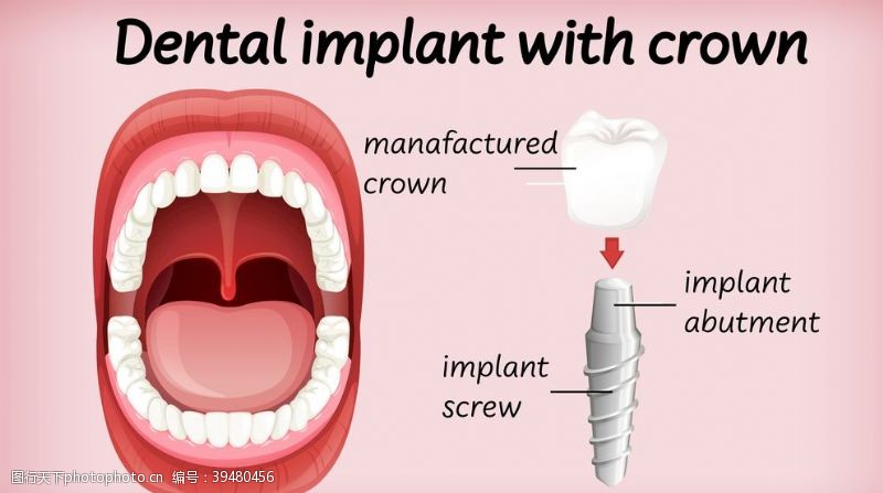种植牙广告牙齿口腔医科图片