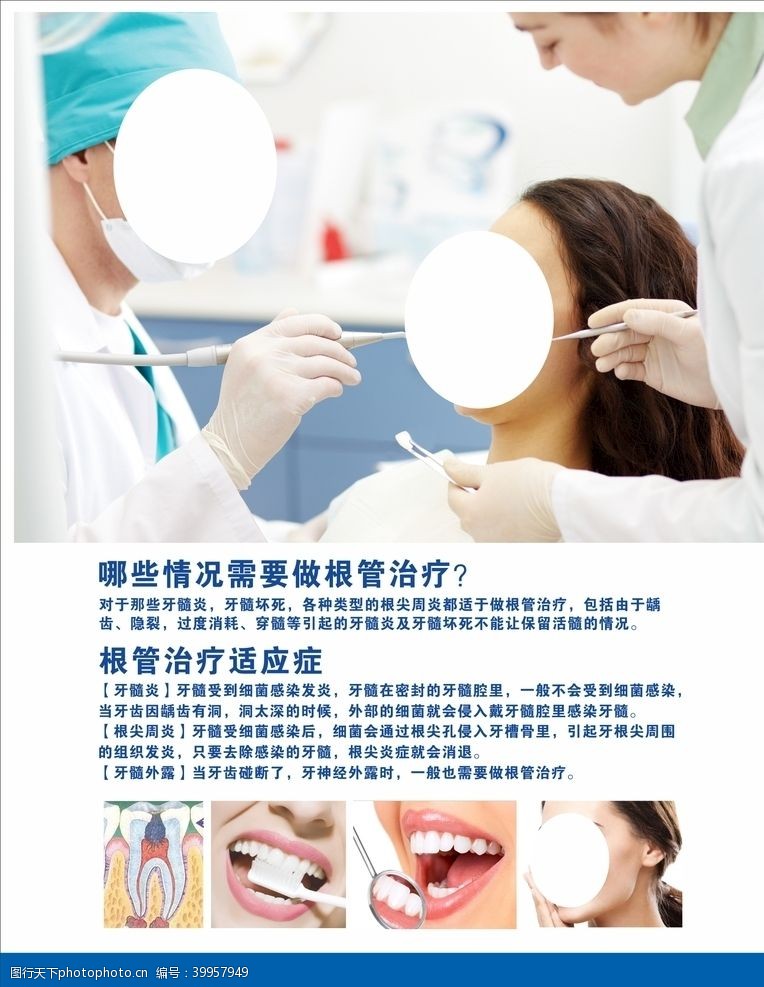 口腔牙科根管治疗图片
