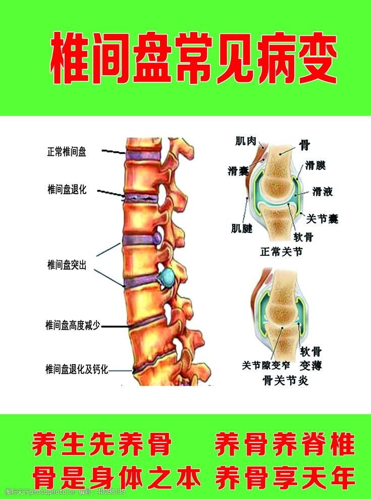 脊椎病脊柱梳理病变图片