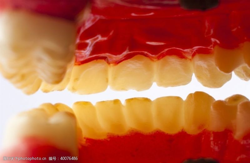 蛀牙牙齿模型图片