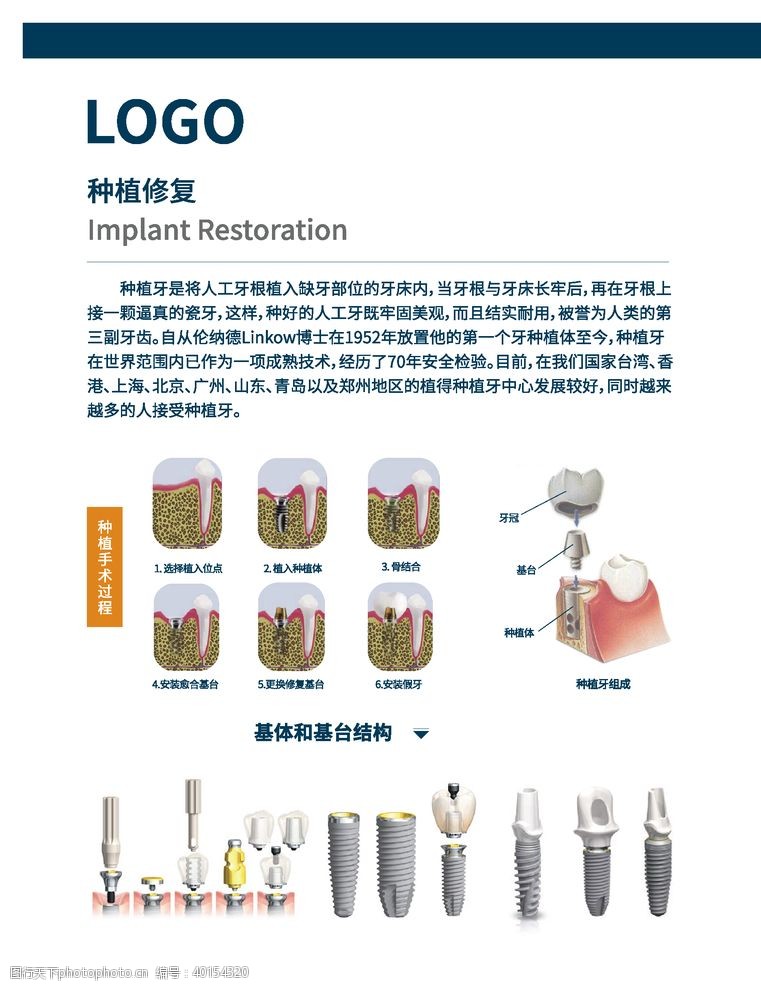 牙医口腔口腔知识种植修复步骤展板海报图图片