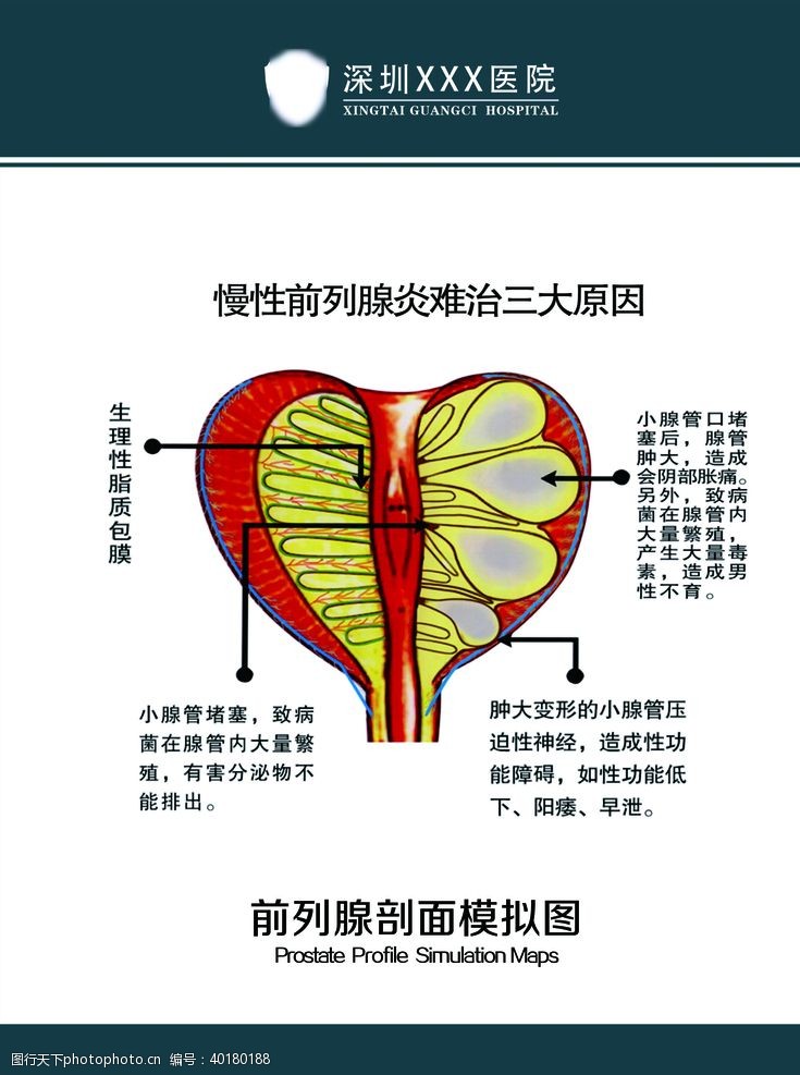 前列腺剖面模拟图图片