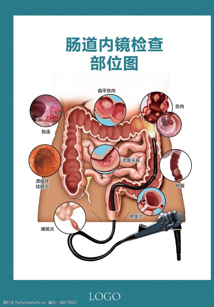消化道肠道内镜检查部位图图片